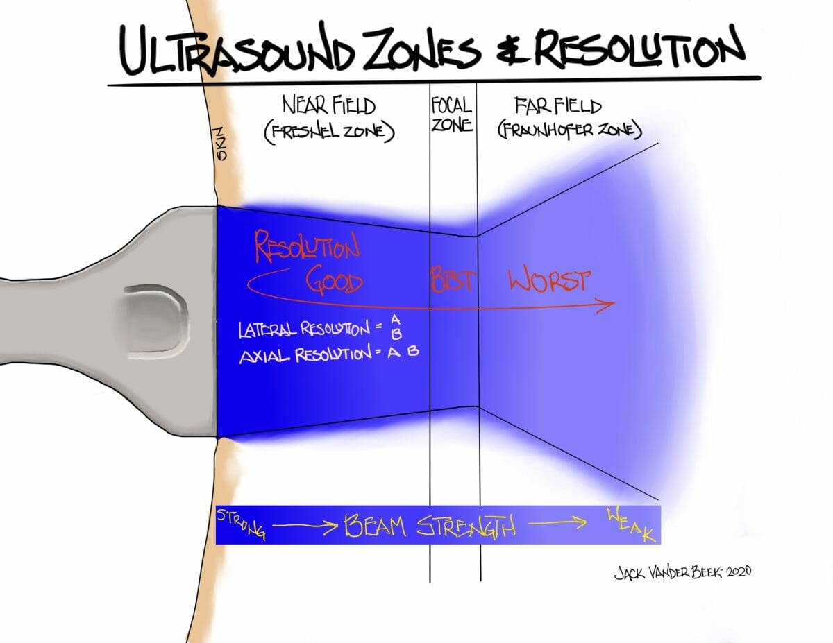 Ultrasound Physics Neuraxiom